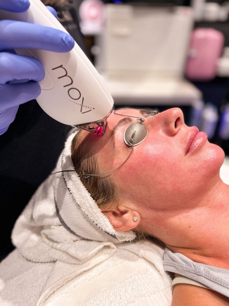 A woman receiving a skincare laser treatment at a beauty salon.