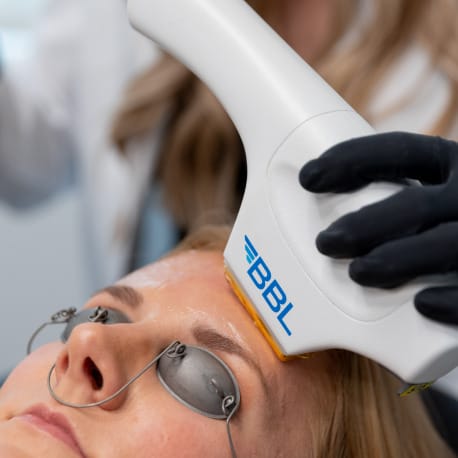 A woman is receiving a laser treatment for her facial skin.