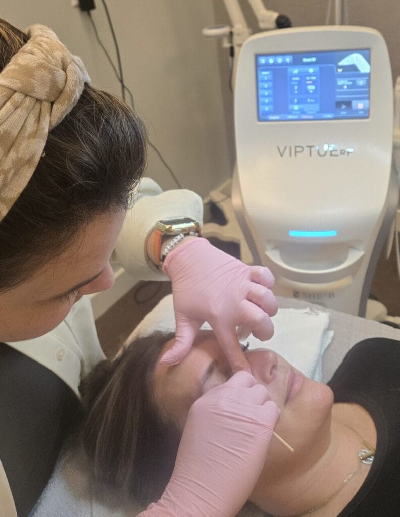 Aesthetician wearing pink gloves performs a microneedling treatment on a woman lying on a treatment bed, with a medical device labeled VIPTOCE in the background for advanced skin rejuvenation.