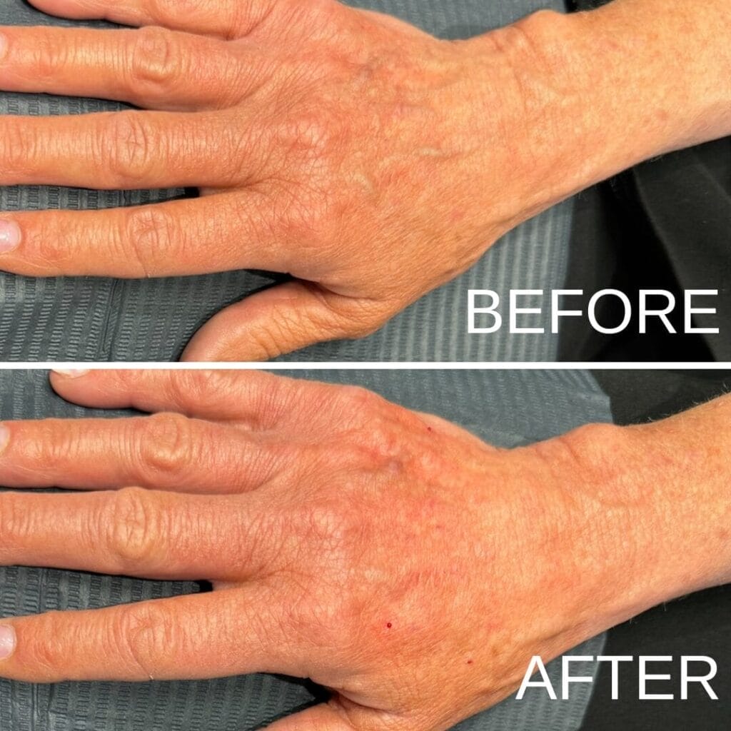 Before and after photo of a woman's hands.