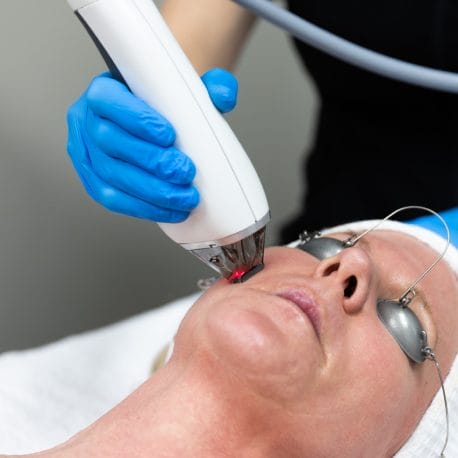 At Center MedSpa, a person lies down for a Light and Laser Magic facial treatment. Wearing protective eyewear, they relax as the practitioner in blue gloves skillfully operates the laser device.