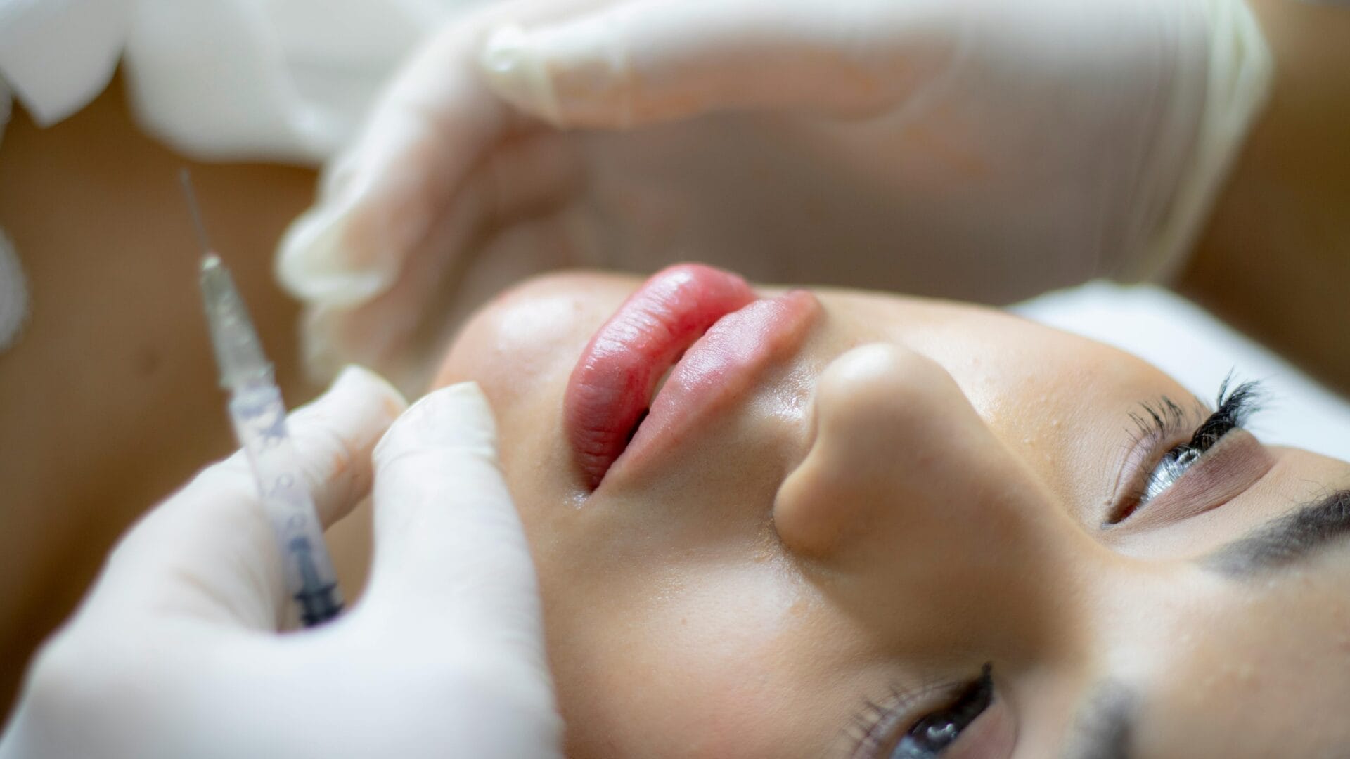 At Center MedSpa, a professional wearing white gloves carefully administers an injectable treatment with a syringe near the patient’s lips.